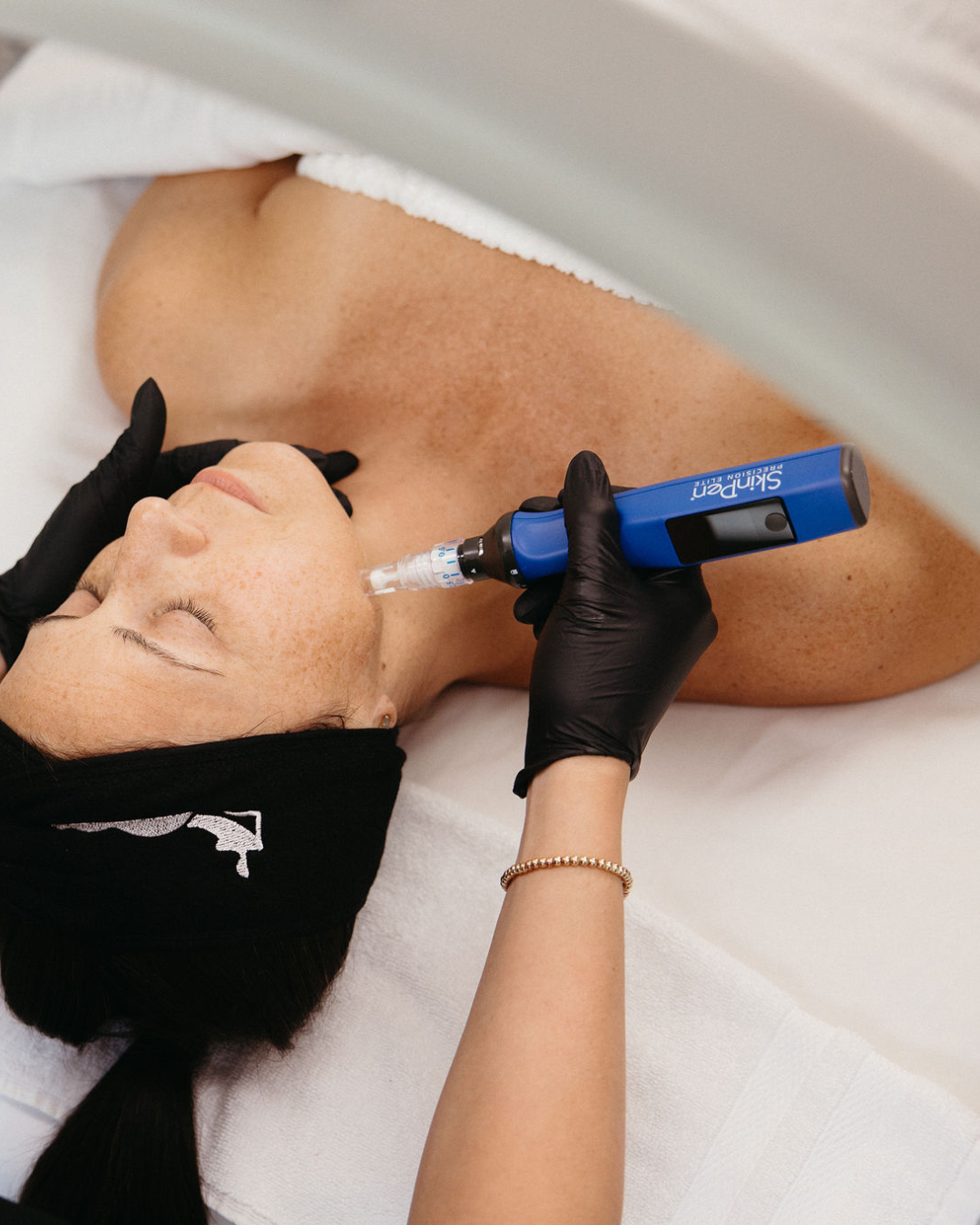 SkinPen Microneedling Session